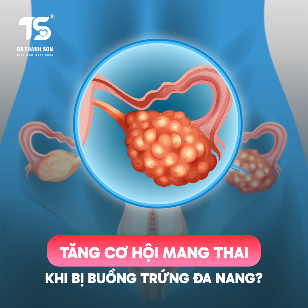 DRTS Facebook ad